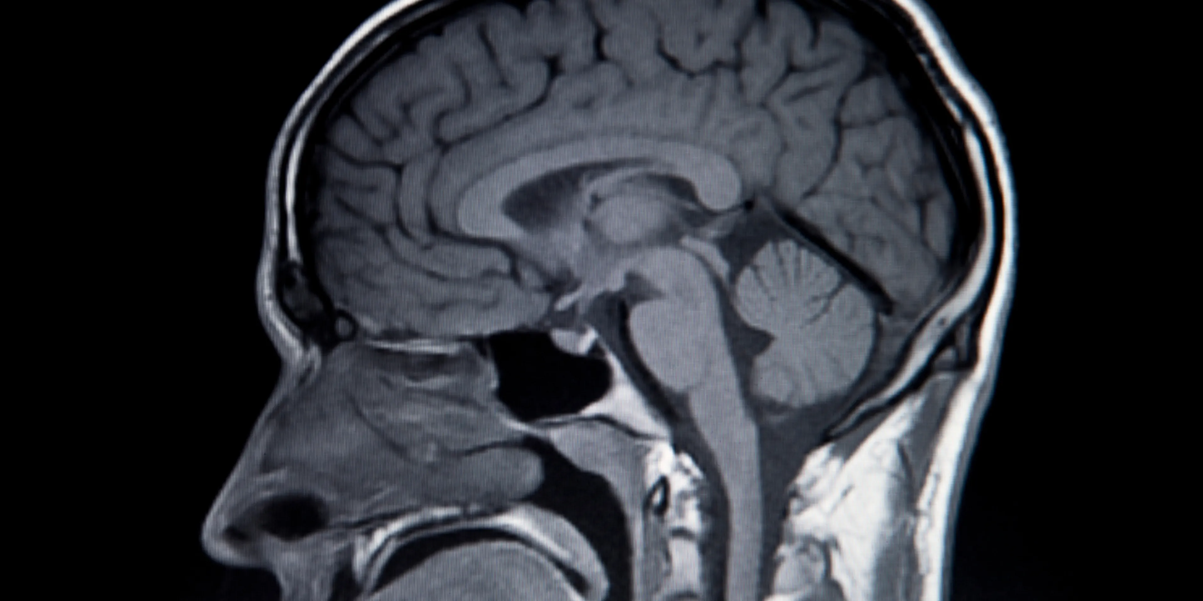 ¿Sabías que la adolescencia termina a los 32 años?