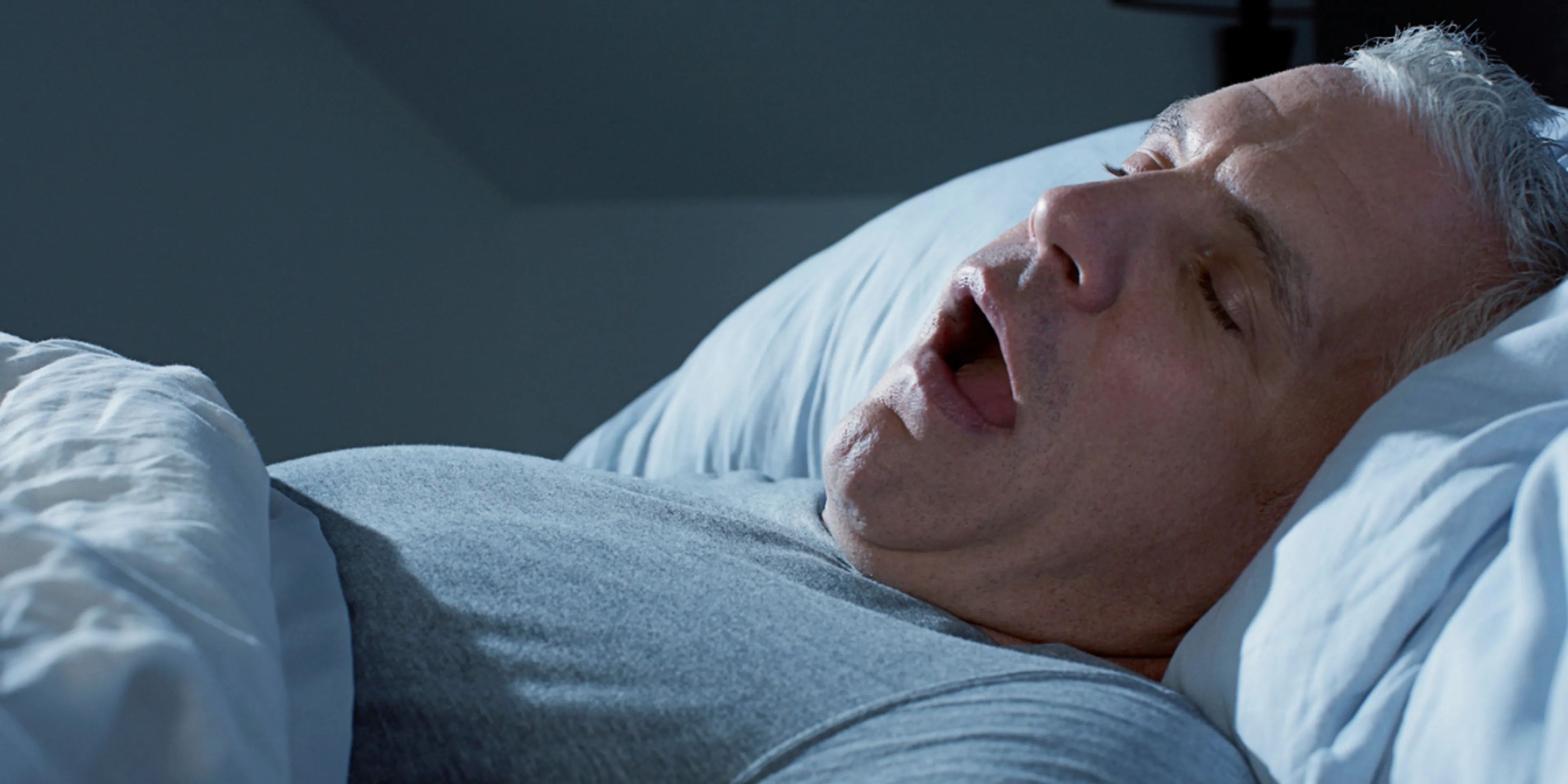 Apnea del sueño obstructiva: qué es y cómo afecta tu salud