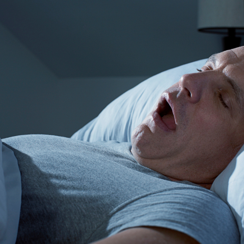 Apnea del sueño obstructiva: qué es y cómo afecta tu salud