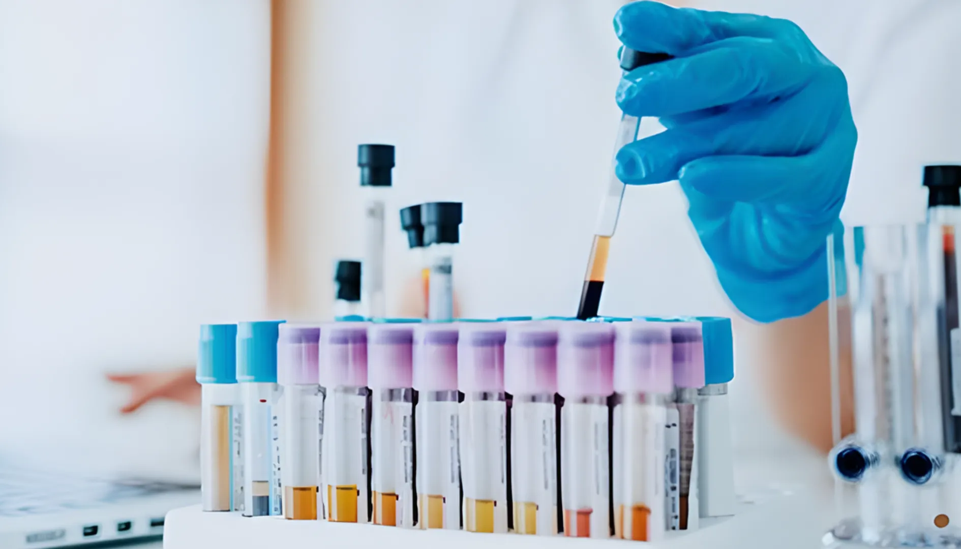 Técnico de laboratorio manipulando muestras de sangre en tubos de ensayo, representando estudios clínicos de alta precisión y análisis de laboratorio confiables.