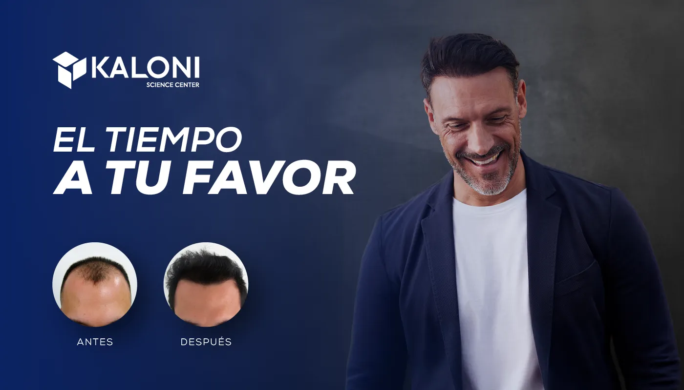 Hombre sonriente con cabello abundante tras un tratamiento capilar, junto al texto “El tiempo a tu favor” y comparativo de antes y después.