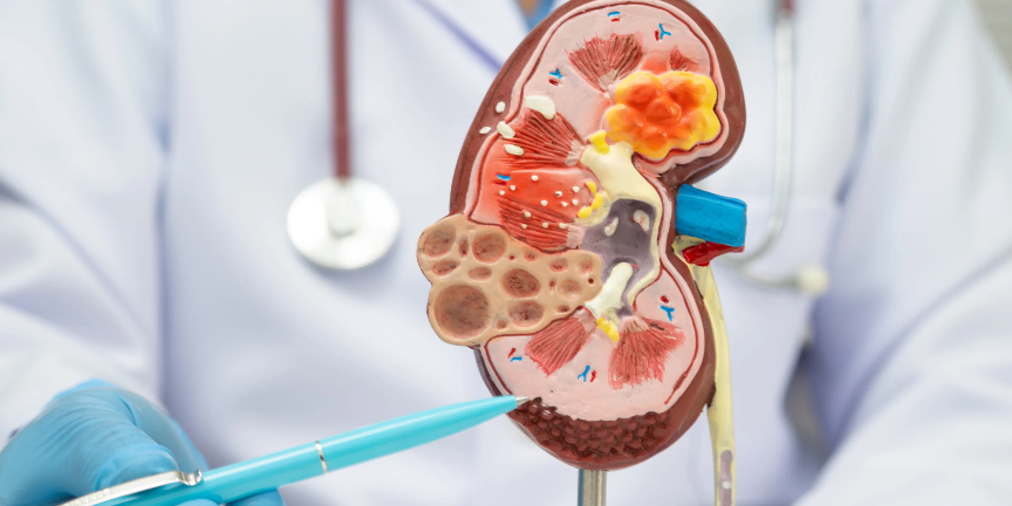 dr. moreno función renal