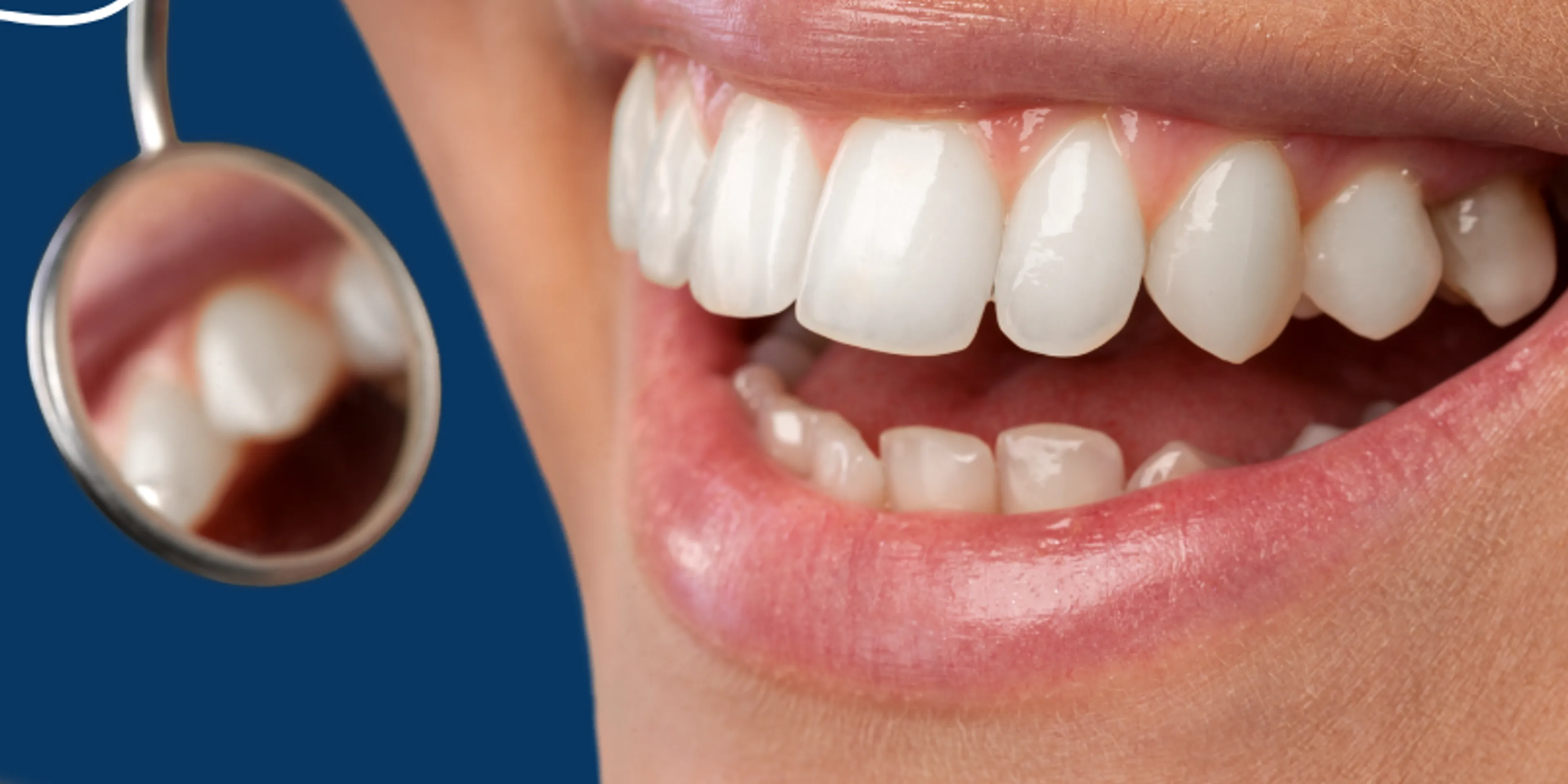 Cosas que tus dientes pueden decir sobre tu salud