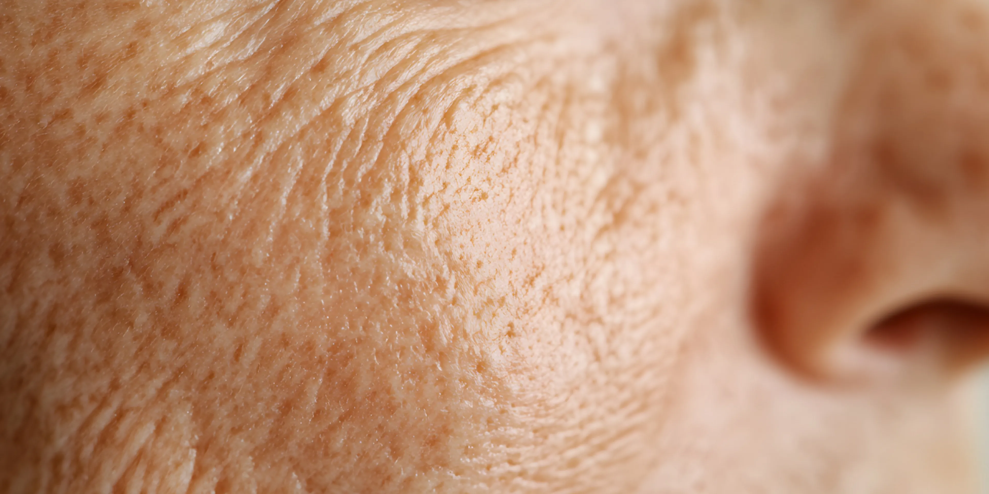 Arrugas: historias que se escriben con el tiempo y se construyen con planeación