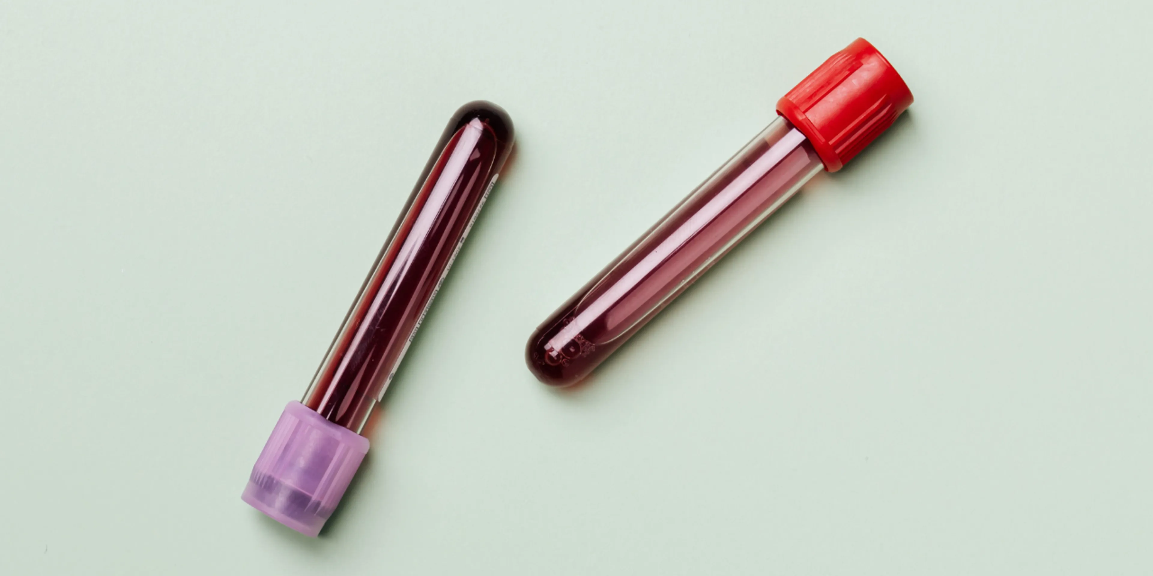 Estudios para detectar el cáncer