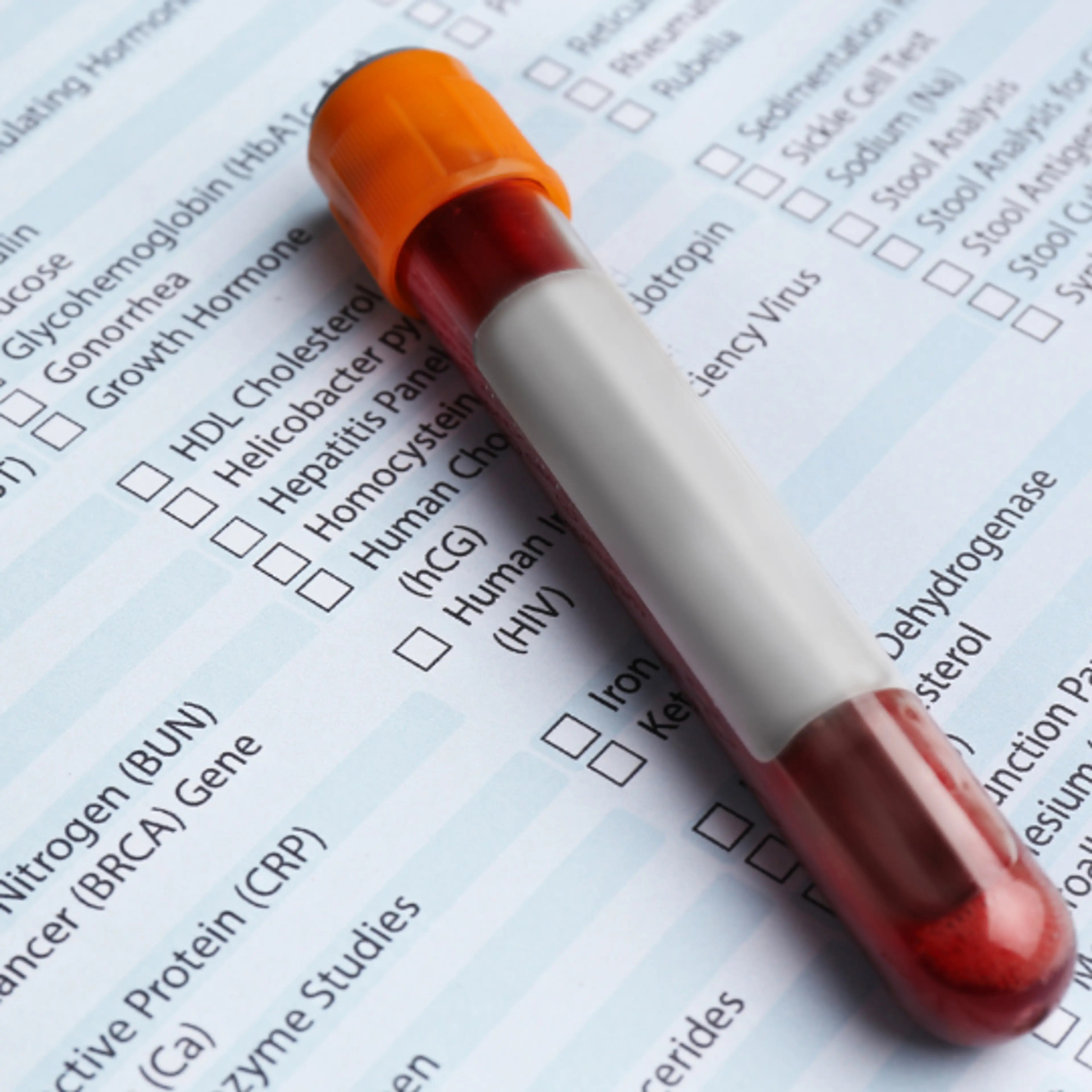 Cuáles son los chequeos médicos comunes que debo hacerme antes de salir de viaje