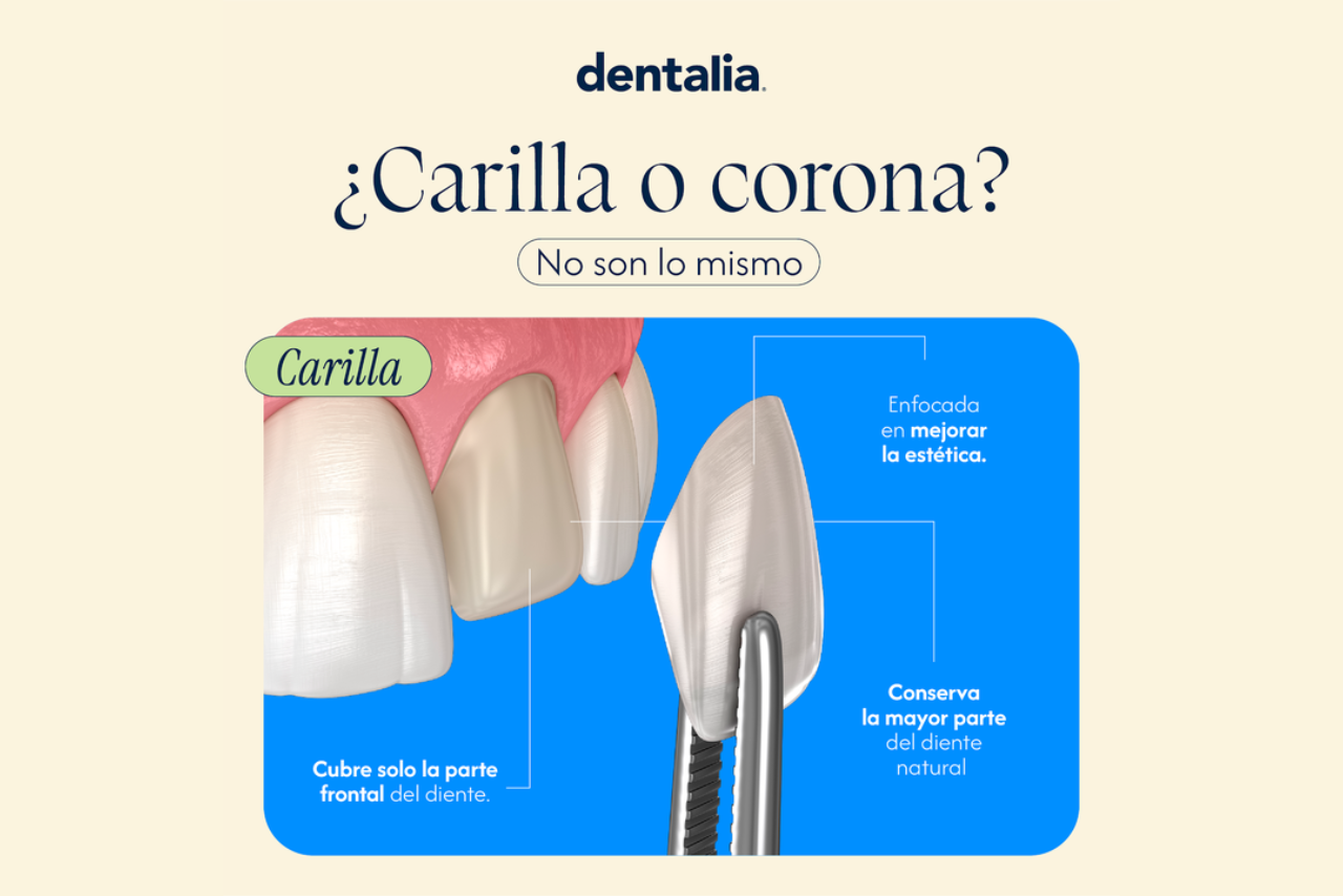 dentalia