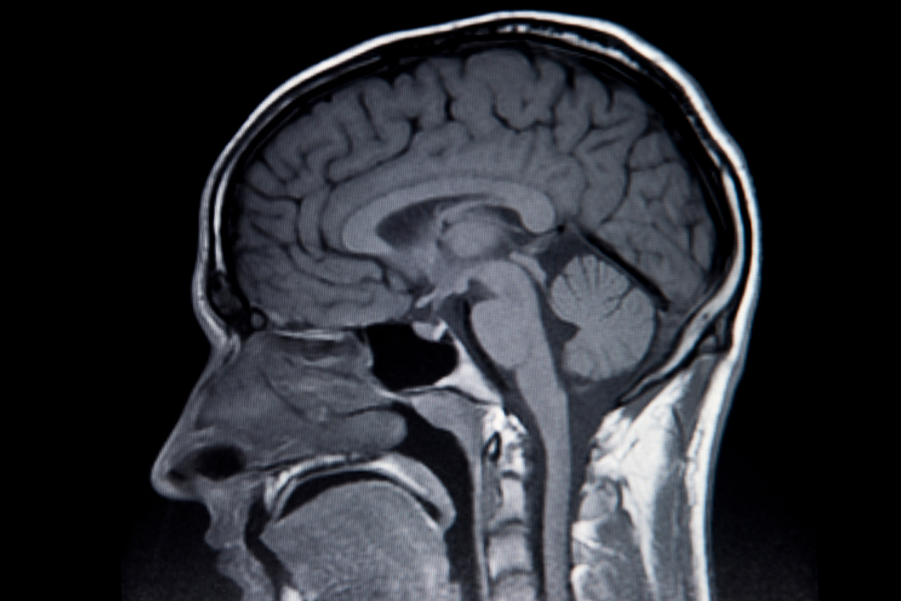 ¿Sabías que la adolescencia termina a los 32 años?