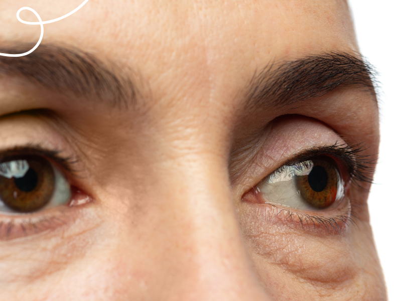 Consejos para el ojo seco