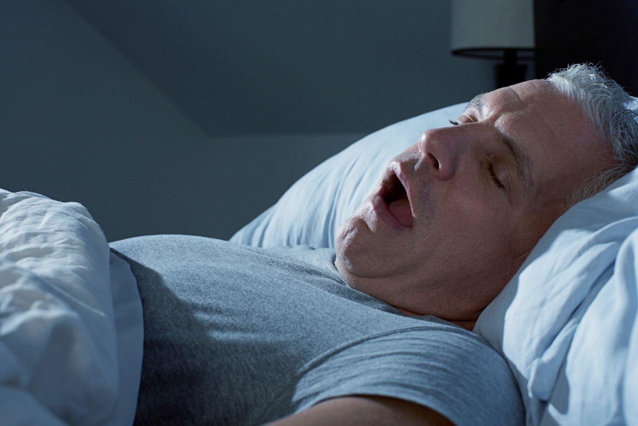 Apnea del sueño obstructiva: qué es y cómo afecta tu salud