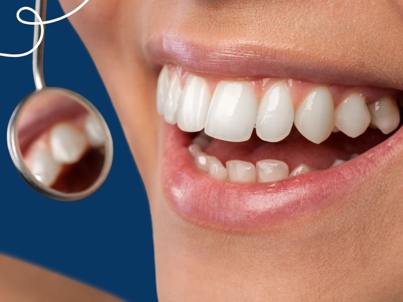 Cosas que tus dientes pueden decir sobre tu salud