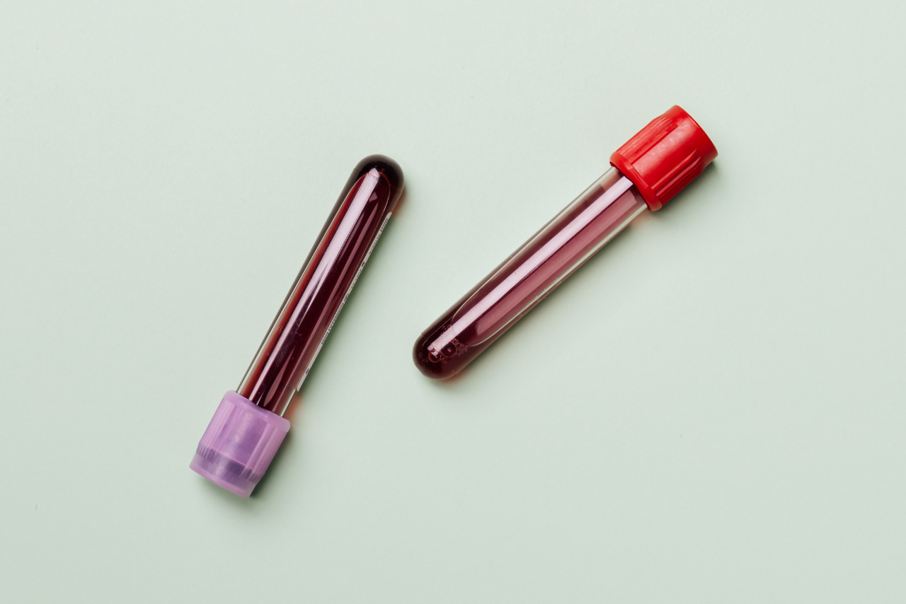 Estudios para detectar el cáncer