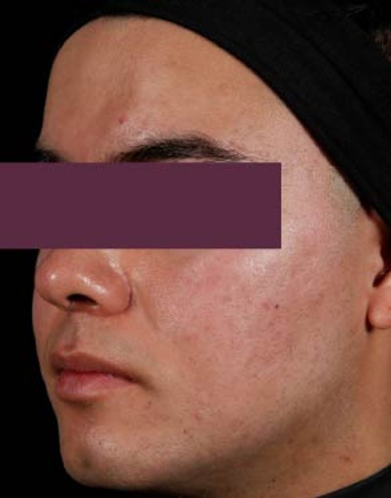 man with clear skin