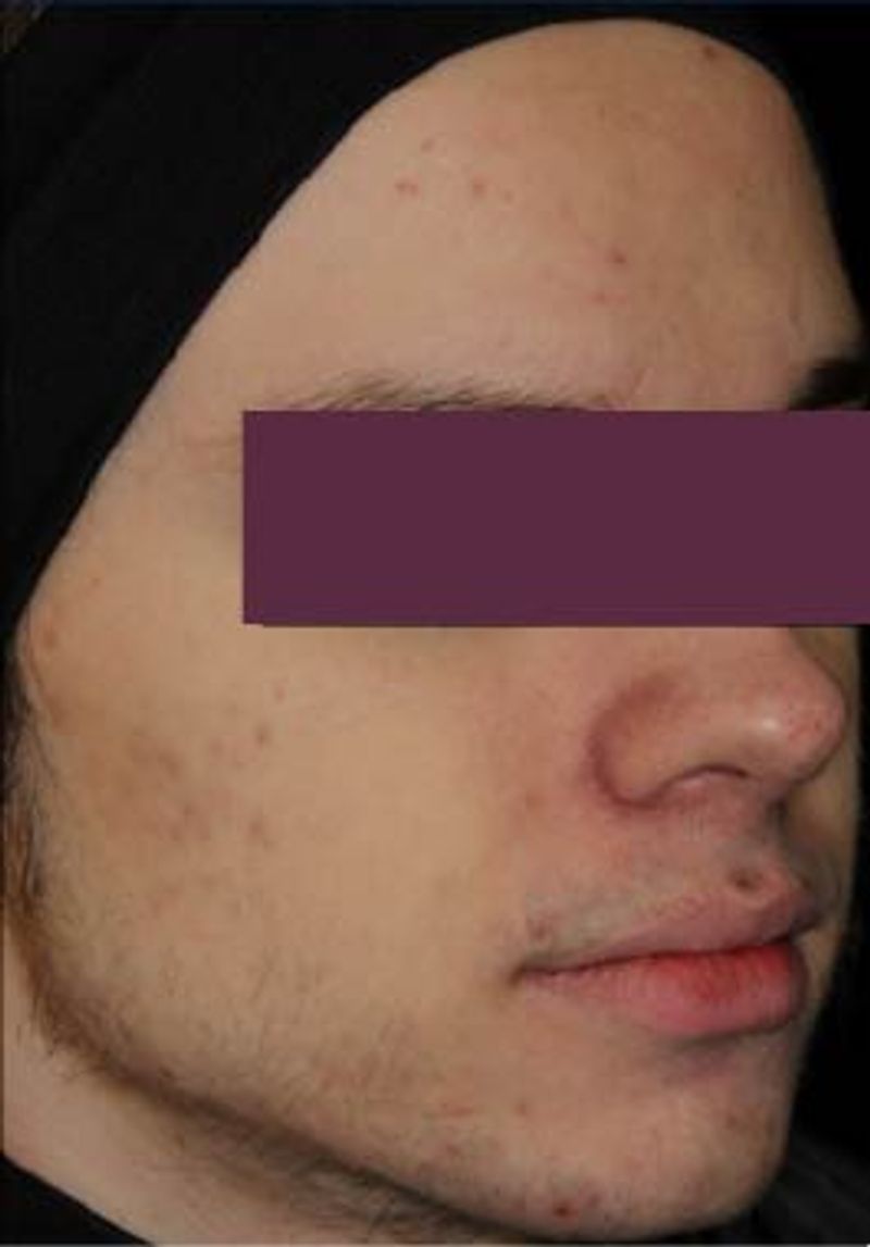 man with clear skin