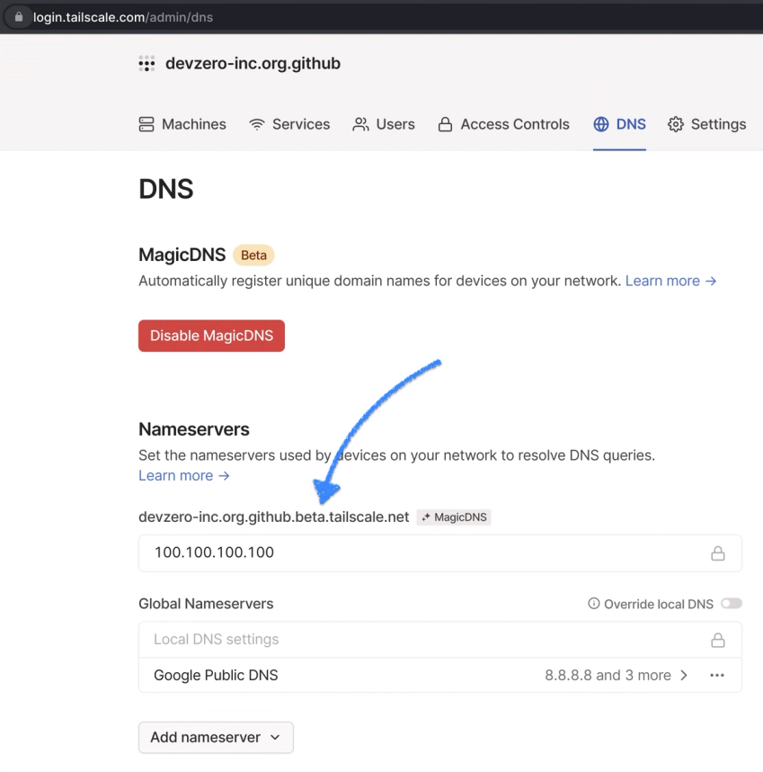 Get Magic DNS server name from Tailscale