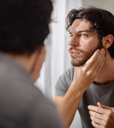 Everything You NEED to Know About Beard Transplants