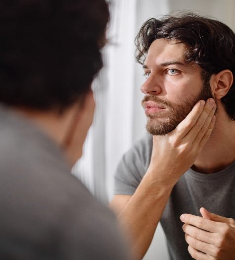 Everything You NEED to Know About Beard Transplants