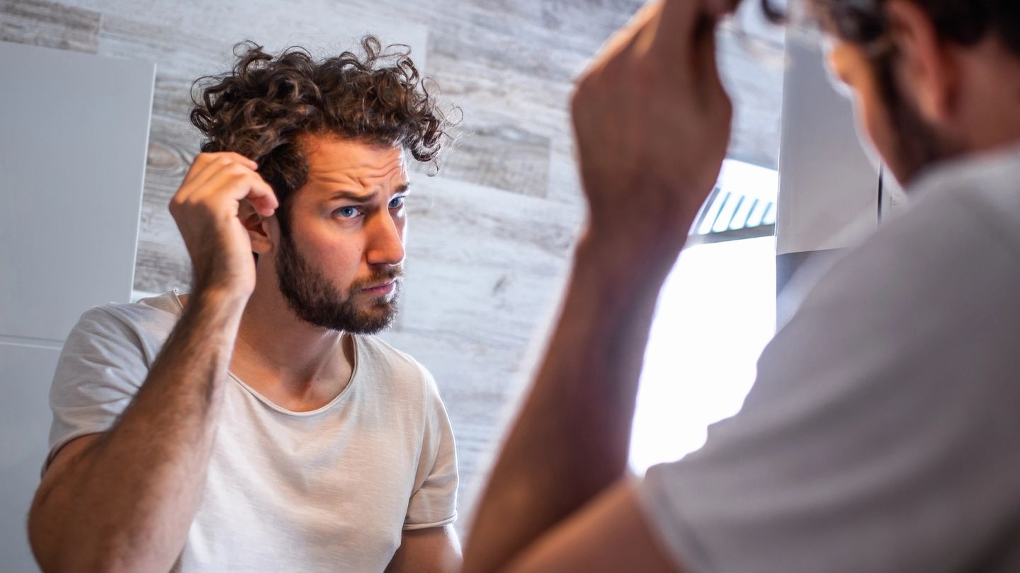 Ten things to consider before getting that hair transplant