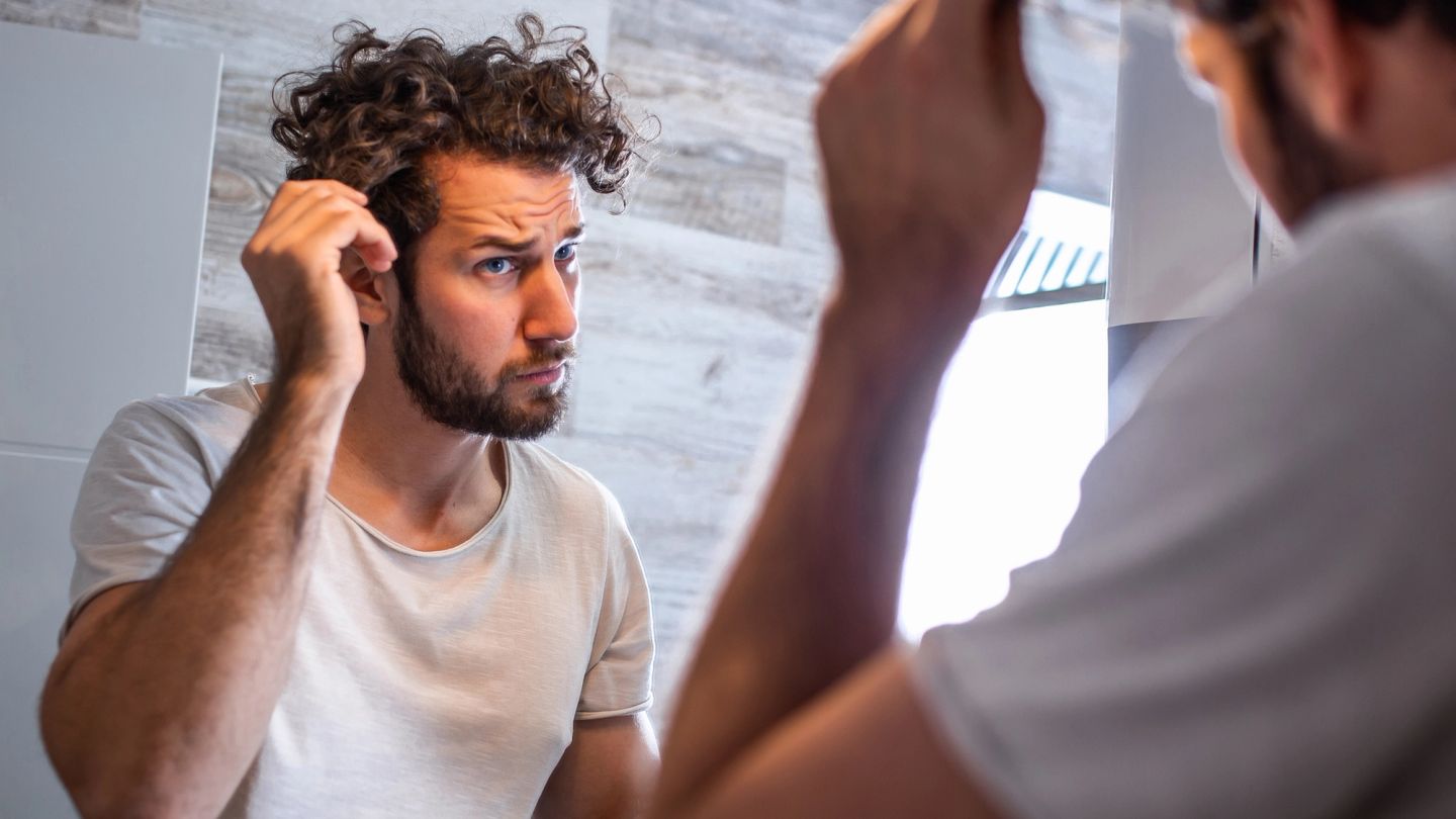 Ten things to consider before getting that hair transplant