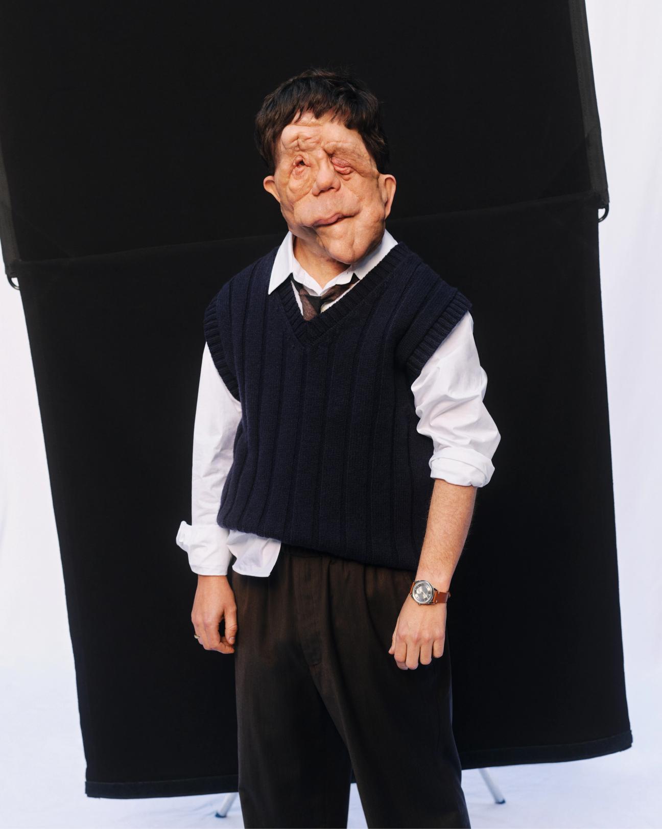 Adam Pearson interview: The A Different Man actor on changing ...