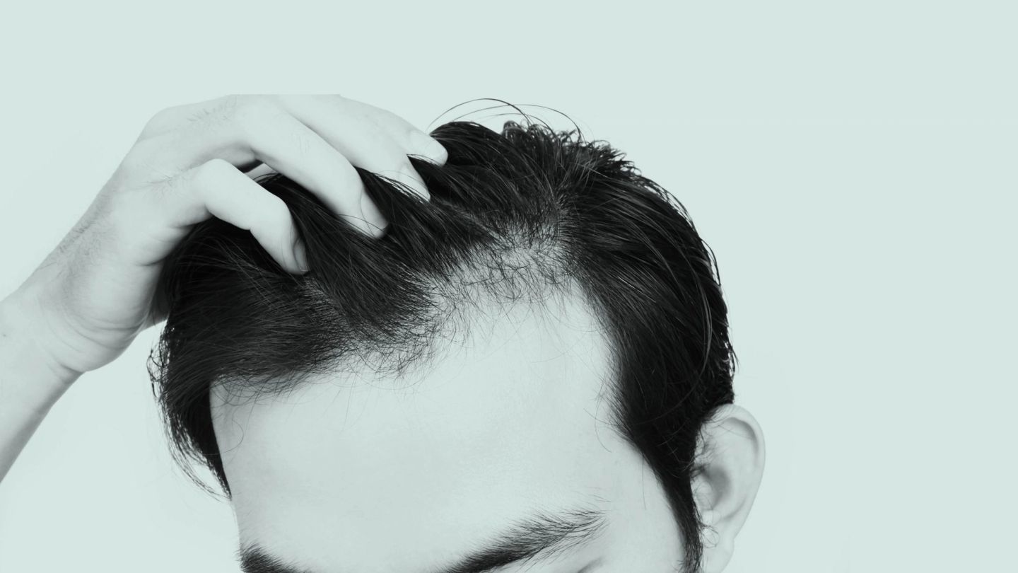 How should you deal with thinning hair?