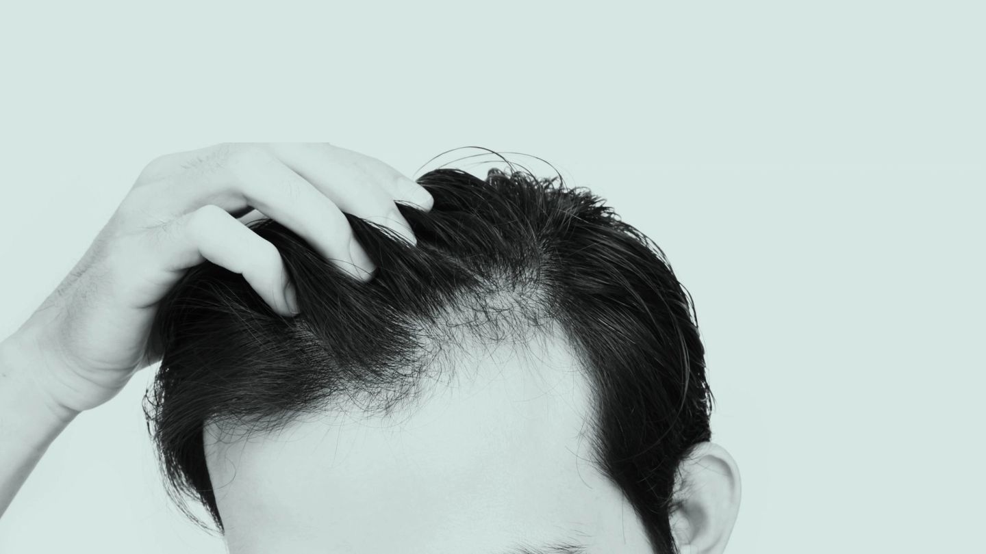 How should you deal with thinning hair?