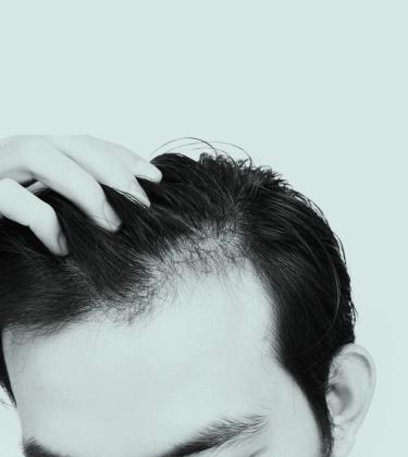 How should you deal with thinning hair?