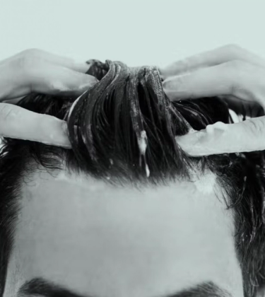What Causes Hair Loss?