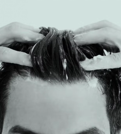 What Causes Hair Loss?