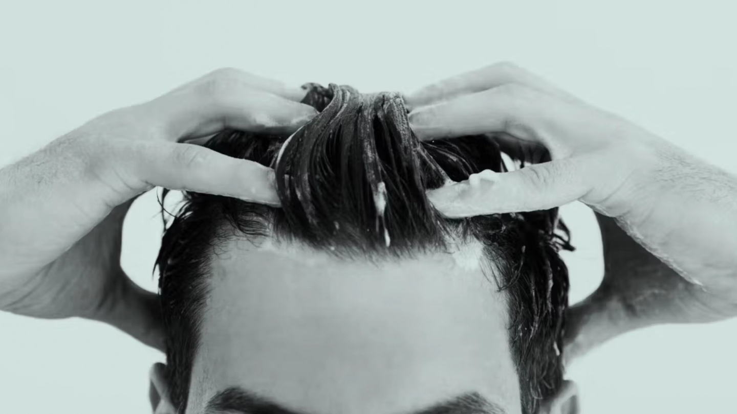 What Causes Hair Loss?