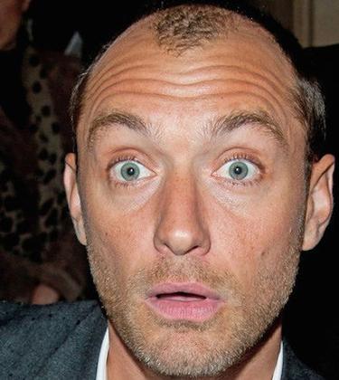 How to tackle premature balding