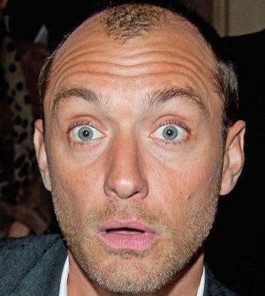 How to tackle premature balding