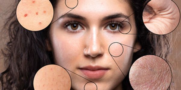 Skin Products Are Not One-Size-Fits-All: Your Guide to Custom Compounded Formulations