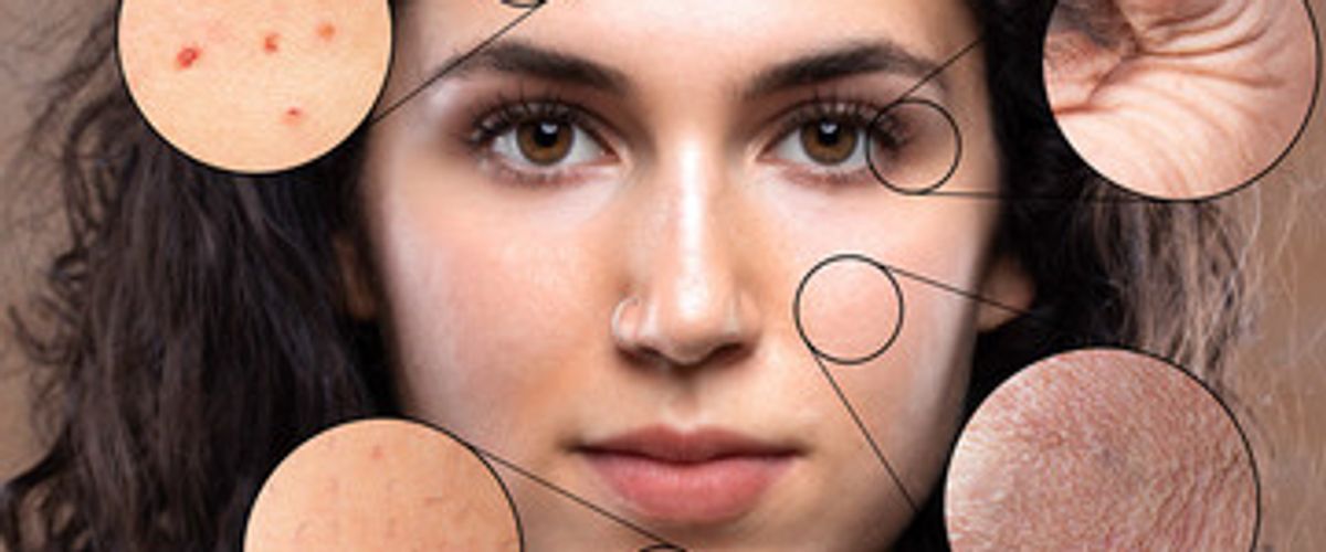 Skin Products Are Not One-Size-Fits-All: Your Guide to Custom Compounded Formulations