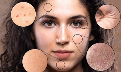 Skin Products Are Not One-Size-Fits-All: Your Guide to Custom Compounded Formulations