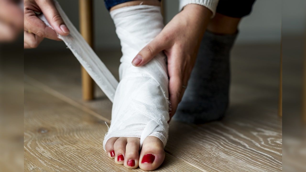 Fractura por estrés: Recuperación y tratamientos