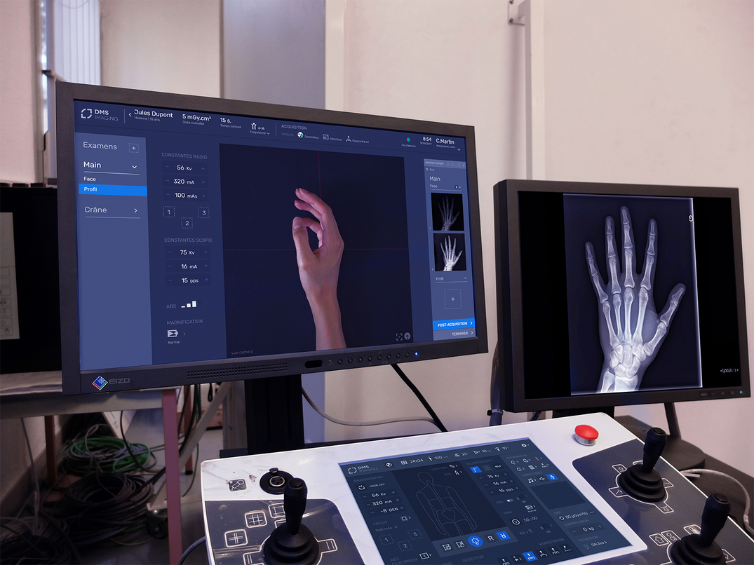 Mock-up de deux interfaces de radiographie fonctionnant ensemble
