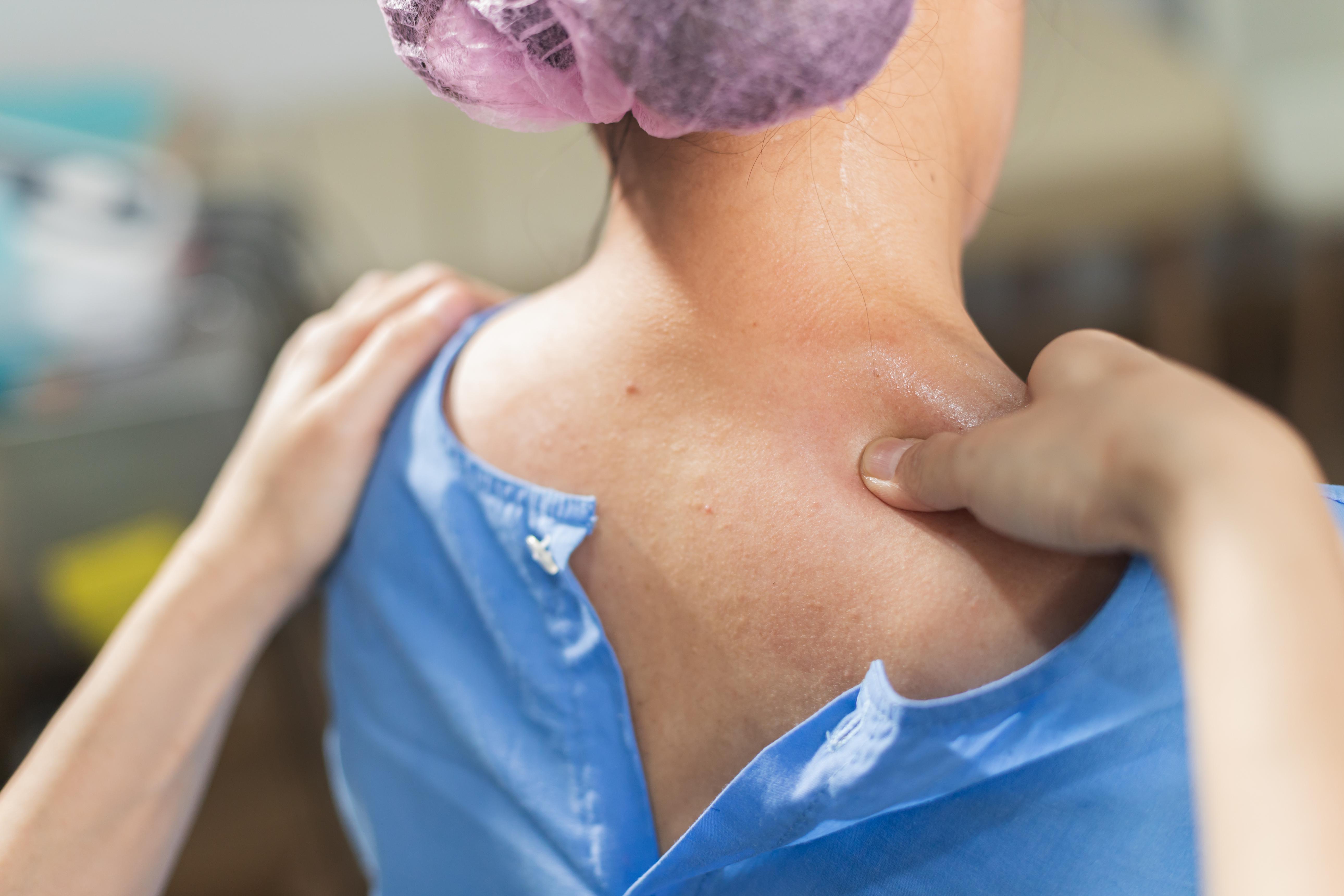 Trigger Point Injection