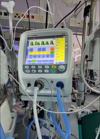 ventilator - neonatologie-sibiu