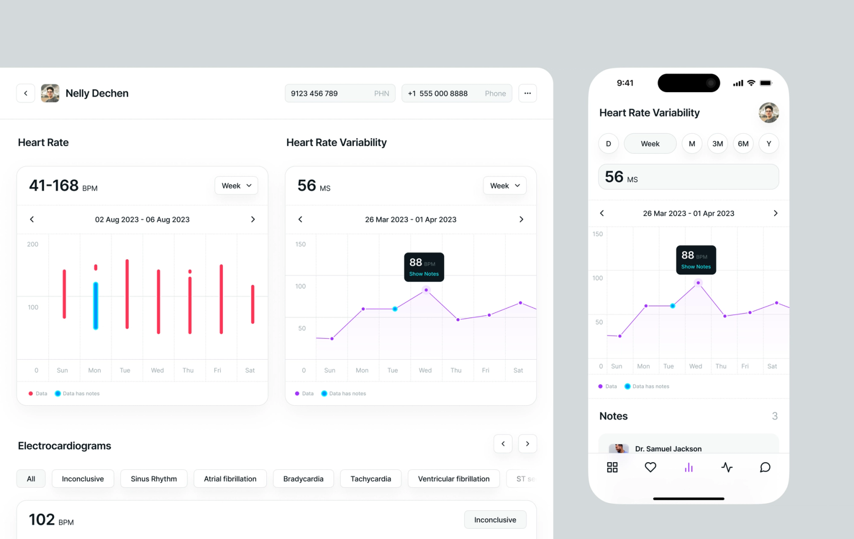 Mobile and desktop views of health tracking app displaying heart rate and variability graphs, along with electrocardiogram data.