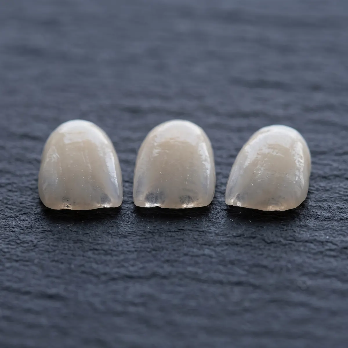 Porcelain veneers: visits and limits