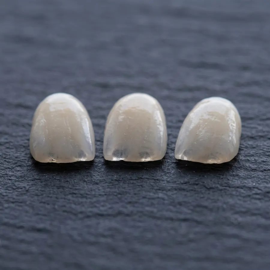 Porcelain Veneers