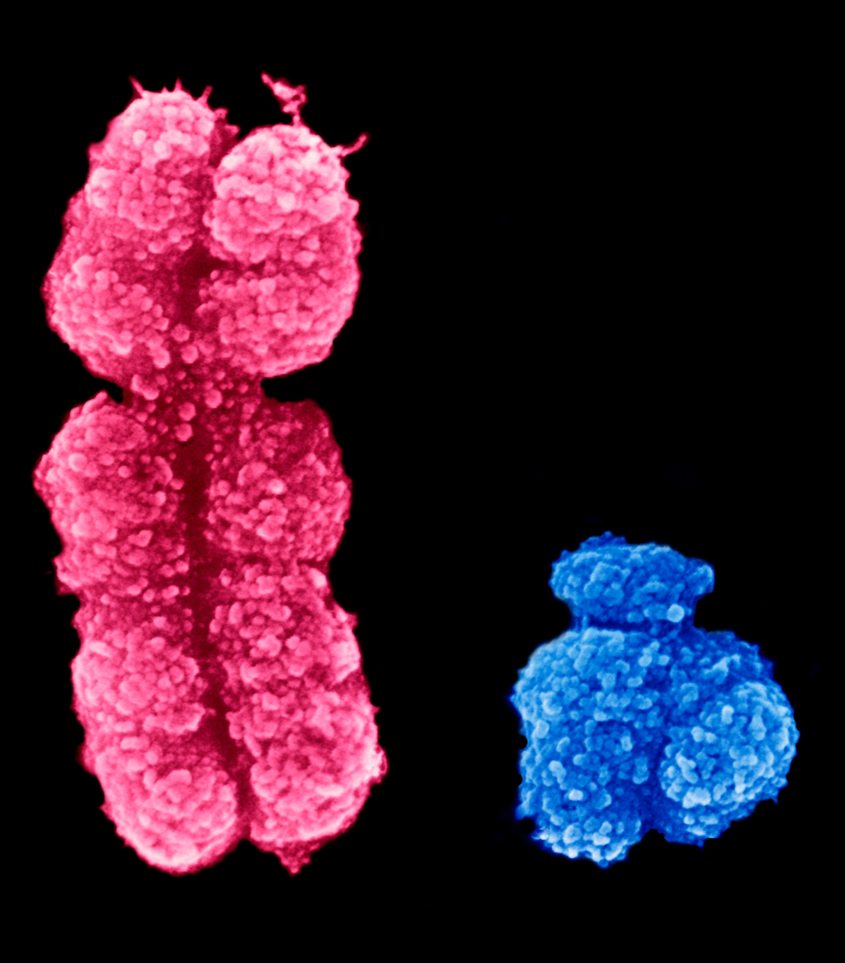 Human Chromosomes