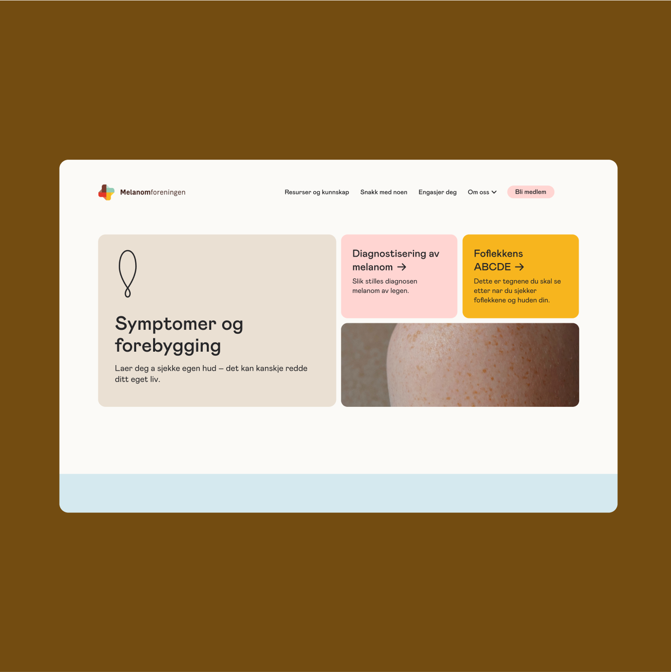 Skjermbilde av siden til Melanomforeningen med symptomer og forebygging.