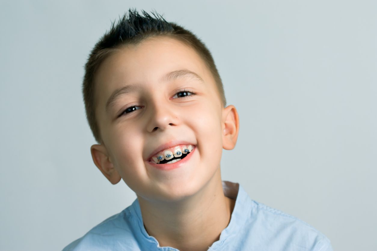 Young boy with braces on shows example of Phase 1 orthodontics early orthodontic treatment