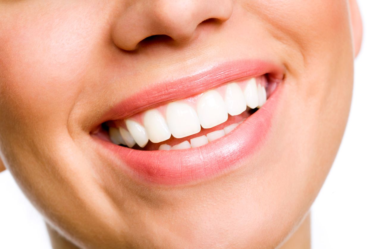 Beautiful smile with brilliant white teeth after teeth whitening