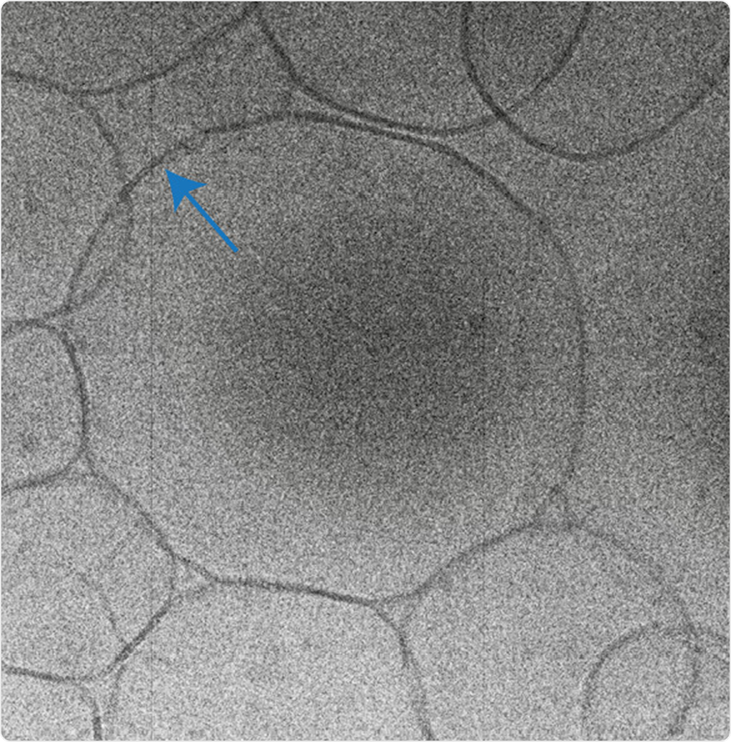 Grainy grayscale micrograph-like field of overlapping rounded forms, with a blue arrow pointing to an edge.