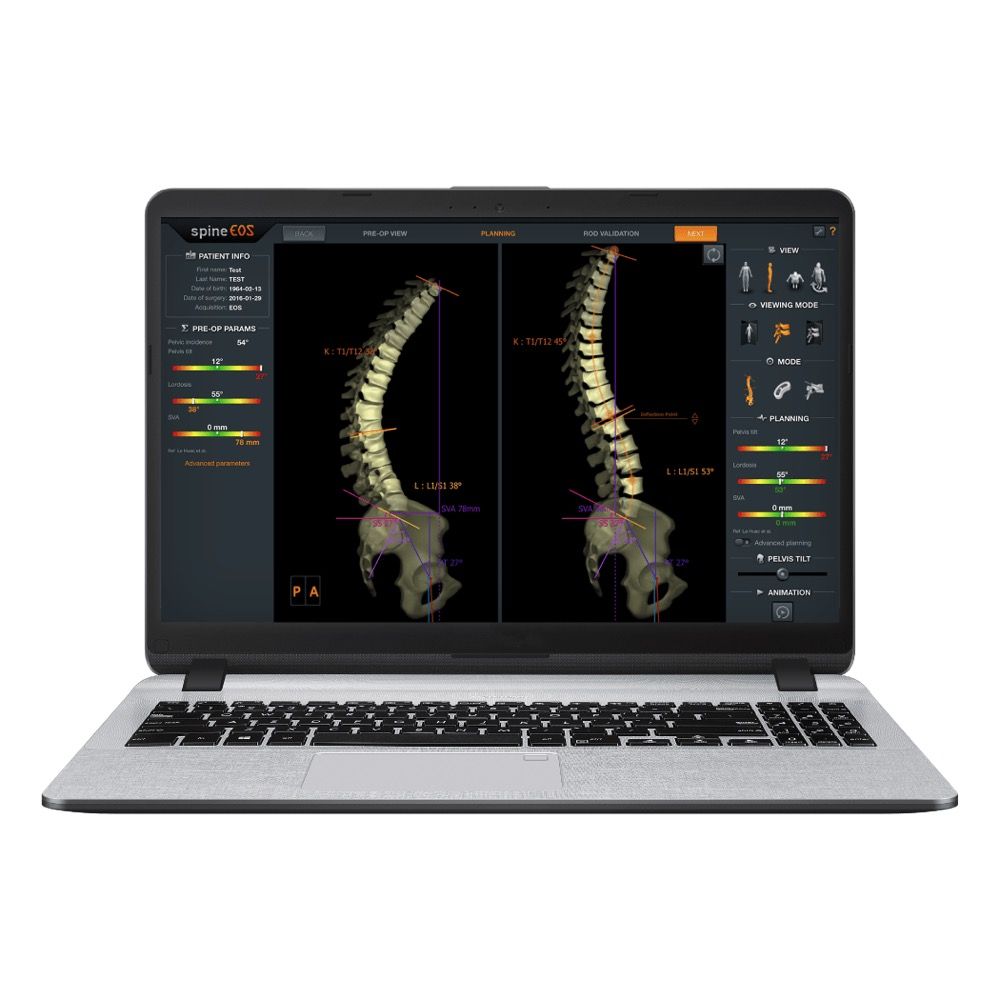 3D Surgical Planning