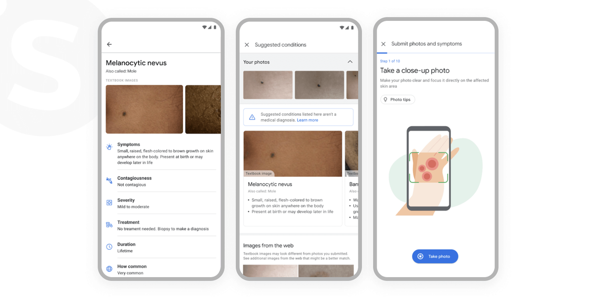 AI for healthcare