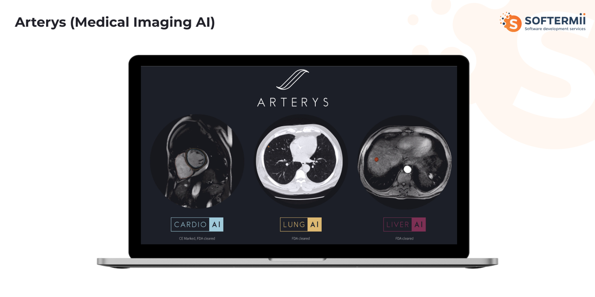 Arterys AI